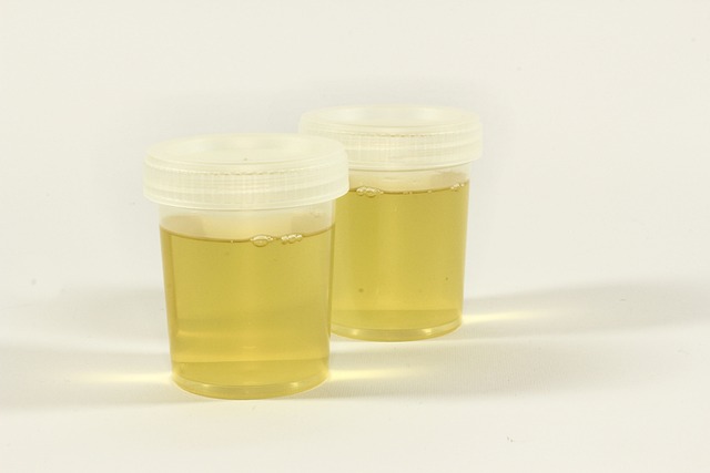 **Spektroskopia Ramana w identyfikacji specyficznych metabolitów bakteryjnych w mikrobiomie skóry atopowej: Nowe markery diagnostyczne i terapeutyczne?**